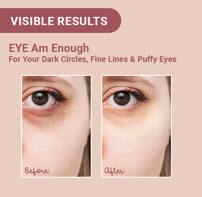 EYE Am Enough Under Eye Cream for Dark Circle Reduction | Complete Under Eye Care with Milk Actives + Micro Encapsulated Caffeine + Multi Peptides