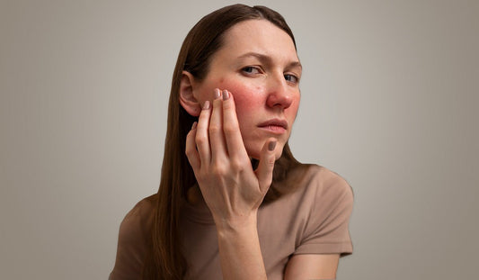 Damn the Monsoon Skin Allergy & Tackle Those Damp Season Skin Issues - Neude Skin