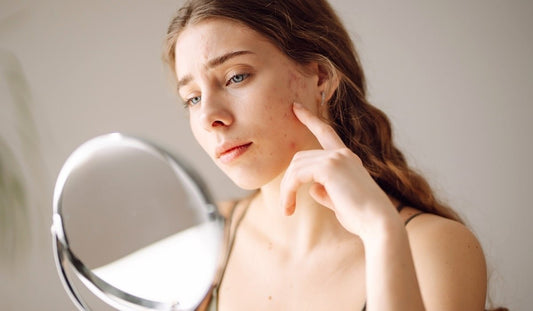Monsoon Breakouts 101: How to Outsmart the Humidity - Neude Skin