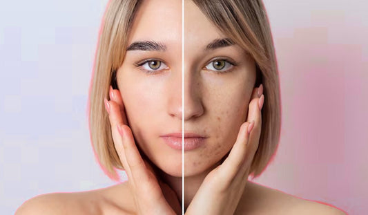 Summer Girl's Vacay List: Neude Products for Supercharged Skin On the Go - Neude Skin