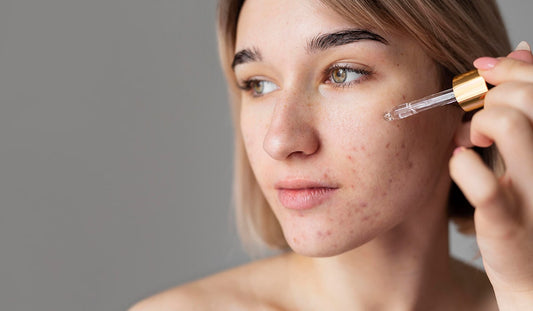 clogged pores in winter