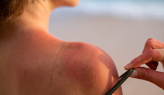 reverse sun damaged skin