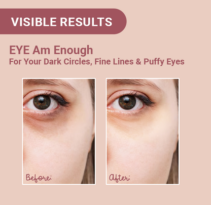 EYE Am Enough Under Eye Cream for Dark Circle Reduction | Complete Under Eye Care with Milk Actives + Micro Encapsulated Caffeine + Multi Peptides